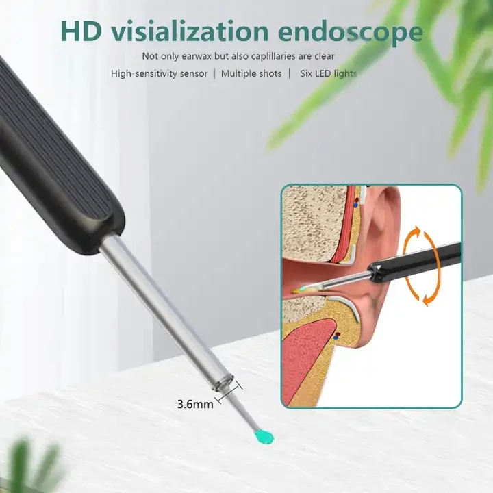 Kit de Remoção de Cera de Ouvido Inteligente IFINE Beauty 3 Eixos com Câmera, Display HD, Conexão Wi-Fi e Otoscópio com Luz - Imagem 5
