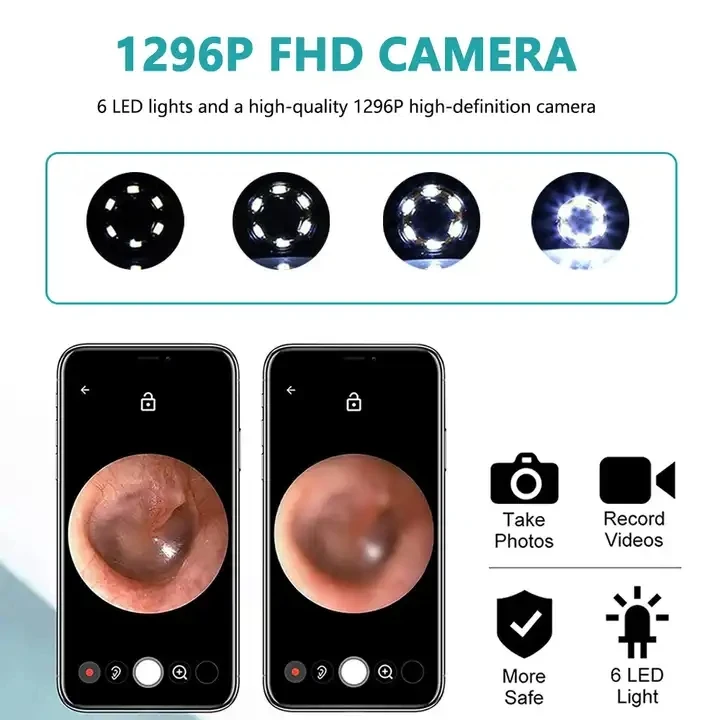 Kit de Remoção de Cera de Ouvido Inteligente IFINE Beauty 3 Eixos com Câmera, Display HD, Conexão Wi-Fi e Otoscópio com Luz - Imagem 4