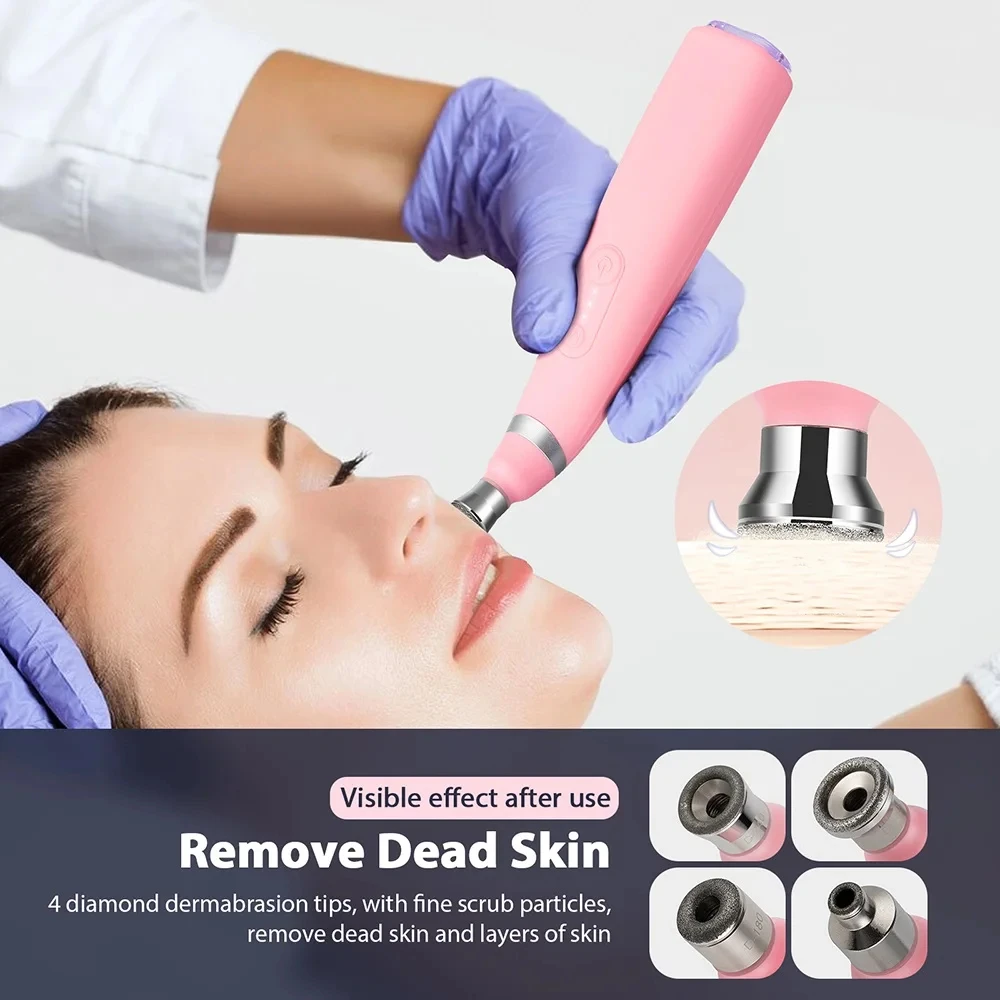 Aparelho de Microdermoabrasão para Limpeza Facial e Remoção de Cravos - Imagem 3