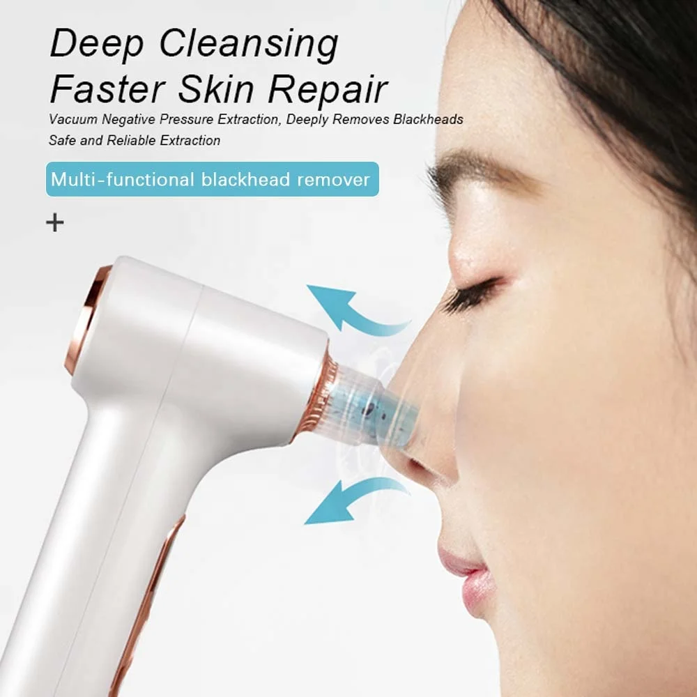 Removedor de Cravos a Vácuo para Limpeza Facial e Remoção de Cravos - Imagem 2