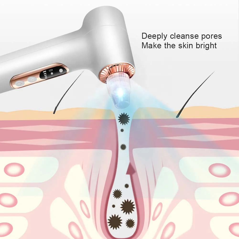 Removedor de Cravos a Vácuo para Limpeza Facial e Remoção de Cravos - Imagem 5