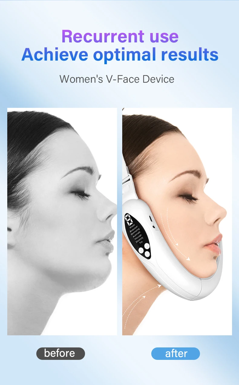 Massageador Facial para Redução de Papada e Firmeza da Pele - Imagem 10