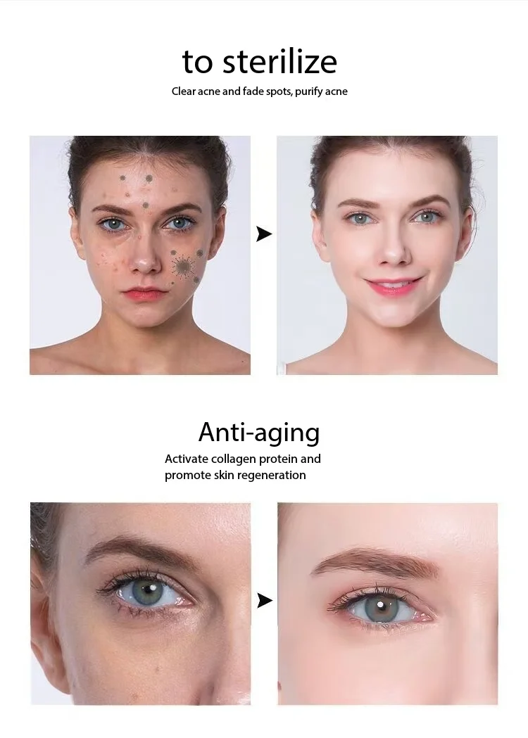 Dispositivo de Plasma Facial para Cuidados Estéticos da Pele - Imagem 6