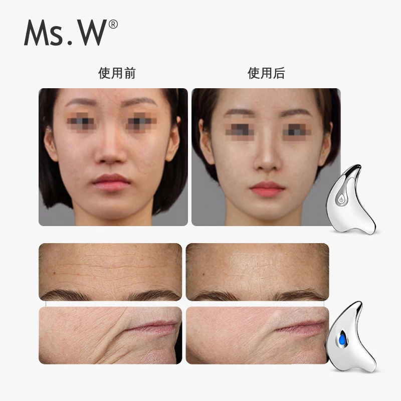Massageador Facial MS.W para Lifting, Firmeza e Absorção de Pele - Imagem 6