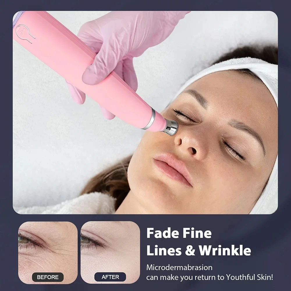 Aparelho de Microdermoabrasão para Limpeza Facial e Remoção de Cravos - Imagem 2