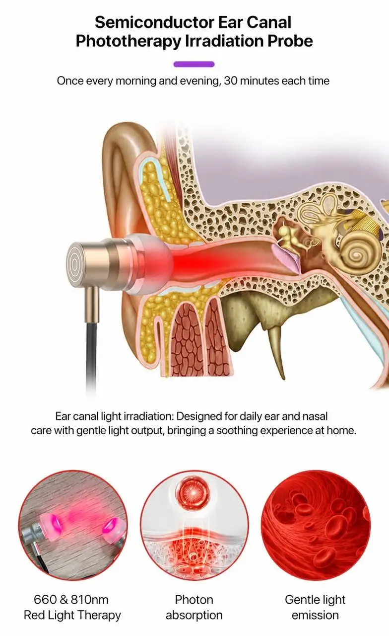 Dispositivo de Fototerapia para Cuidados Nasais e Auriculares UOYO - Imagem 6