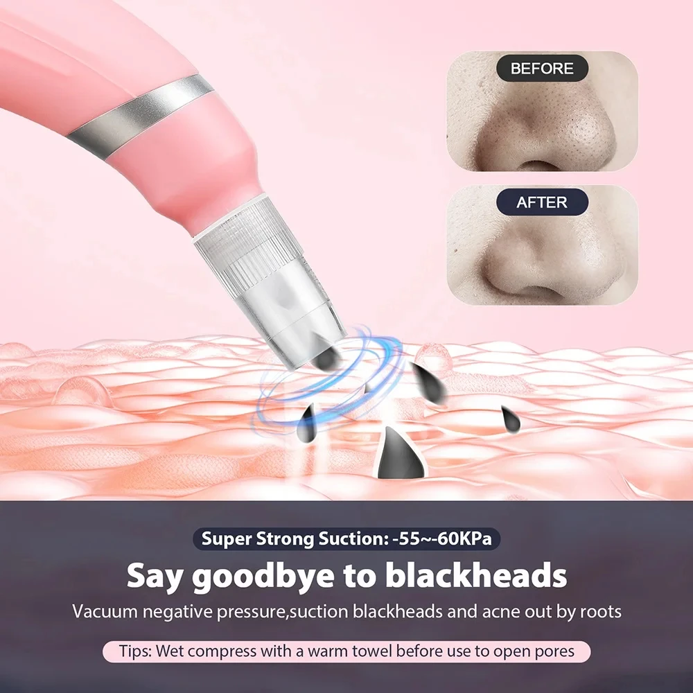 Aparelho de Microdermoabrasão para Limpeza Facial e Remoção de Cravos - Imagem 4