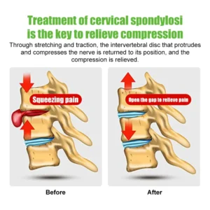 Kit de Tração Cervical para Alívio de Tensão e Dor no Pescoço