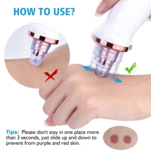 Removedor de Cravos e Limpador de Poros para Limpeza Facial