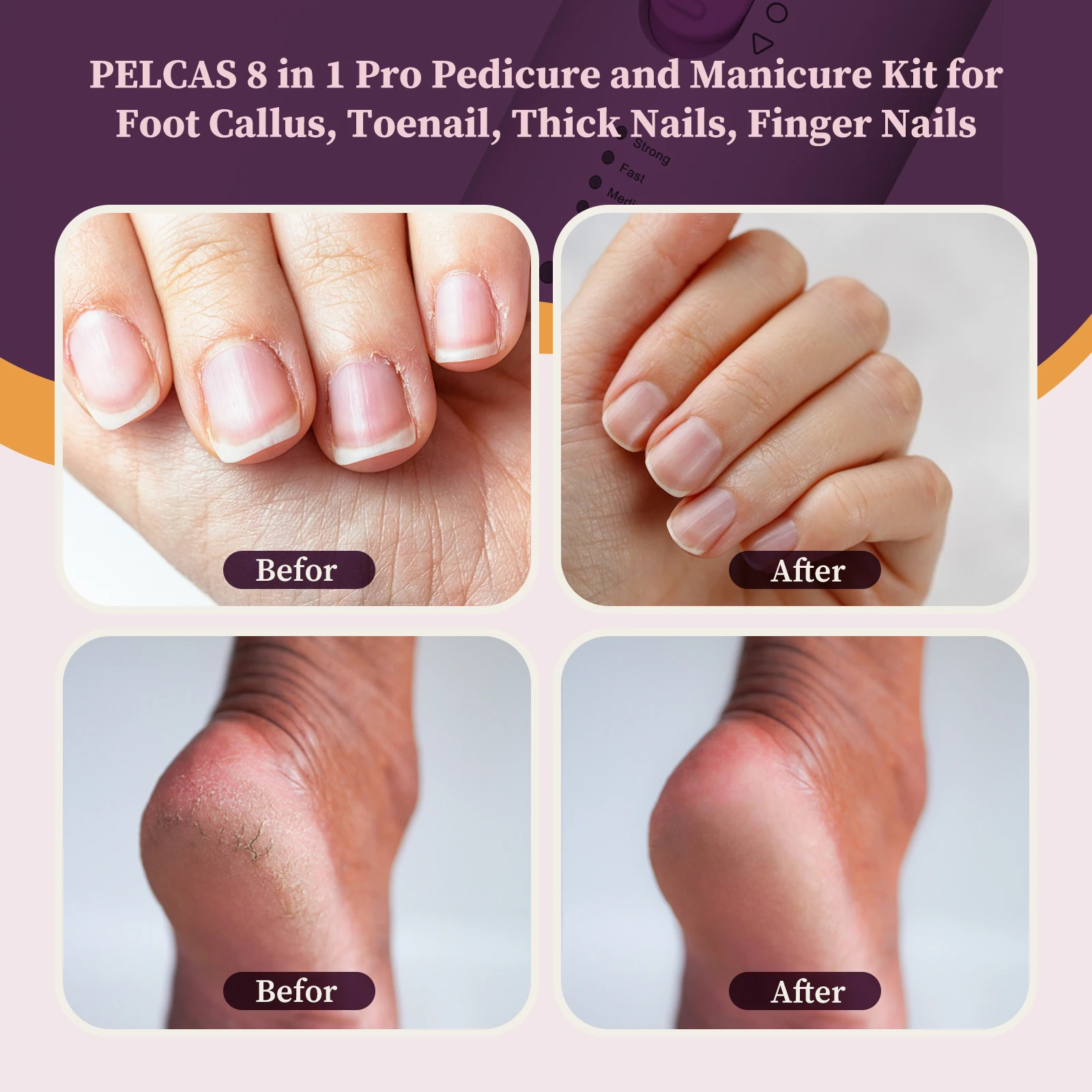 Lixadeira Elétrica de Unhas para Manicure e Pedicure - Imagem 3