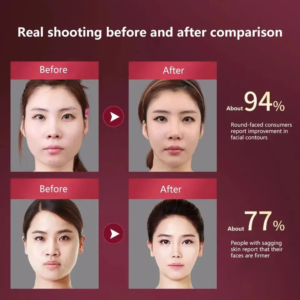 Massageador Facial com Fototerapia e Vibração para Lifting e Firmeza - Imagem 23