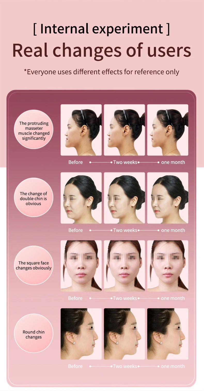 Massageador Facial com Fototerapia e Vibração para Lifting e Firmeza - Imagem 4